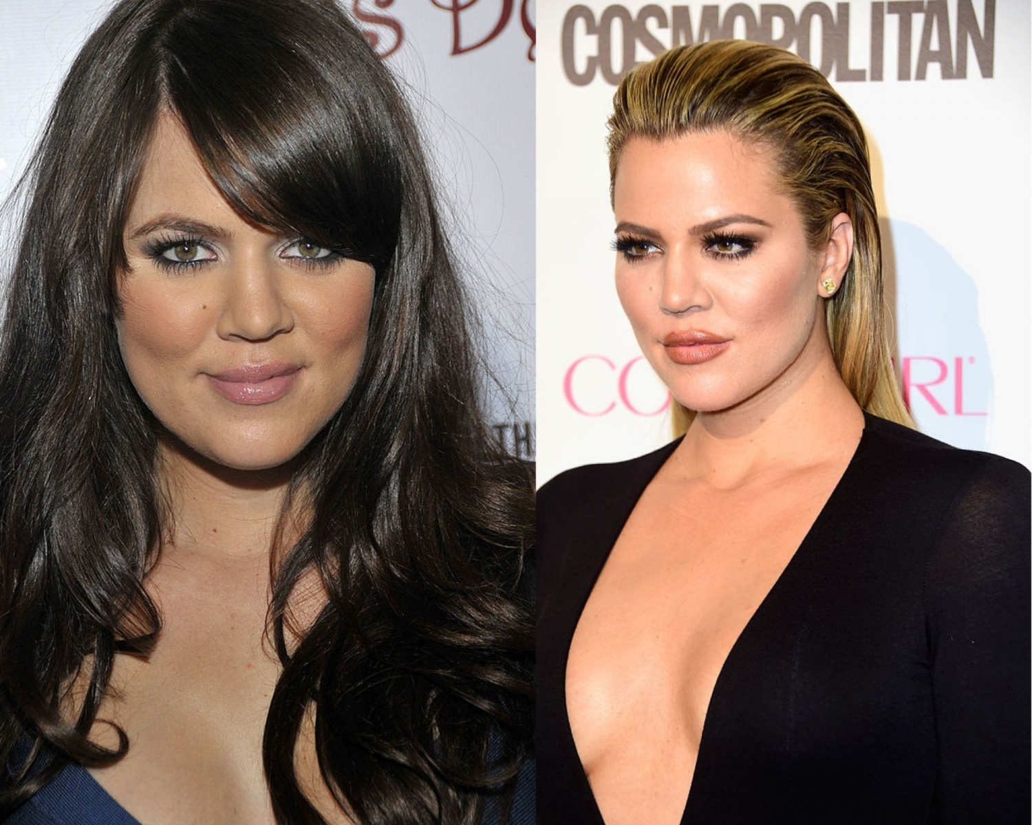Khloe Kardashian Then And Now All The Surgeries She May Have Had Since 2008 According To Surgeon Photos Celebrities Enstars