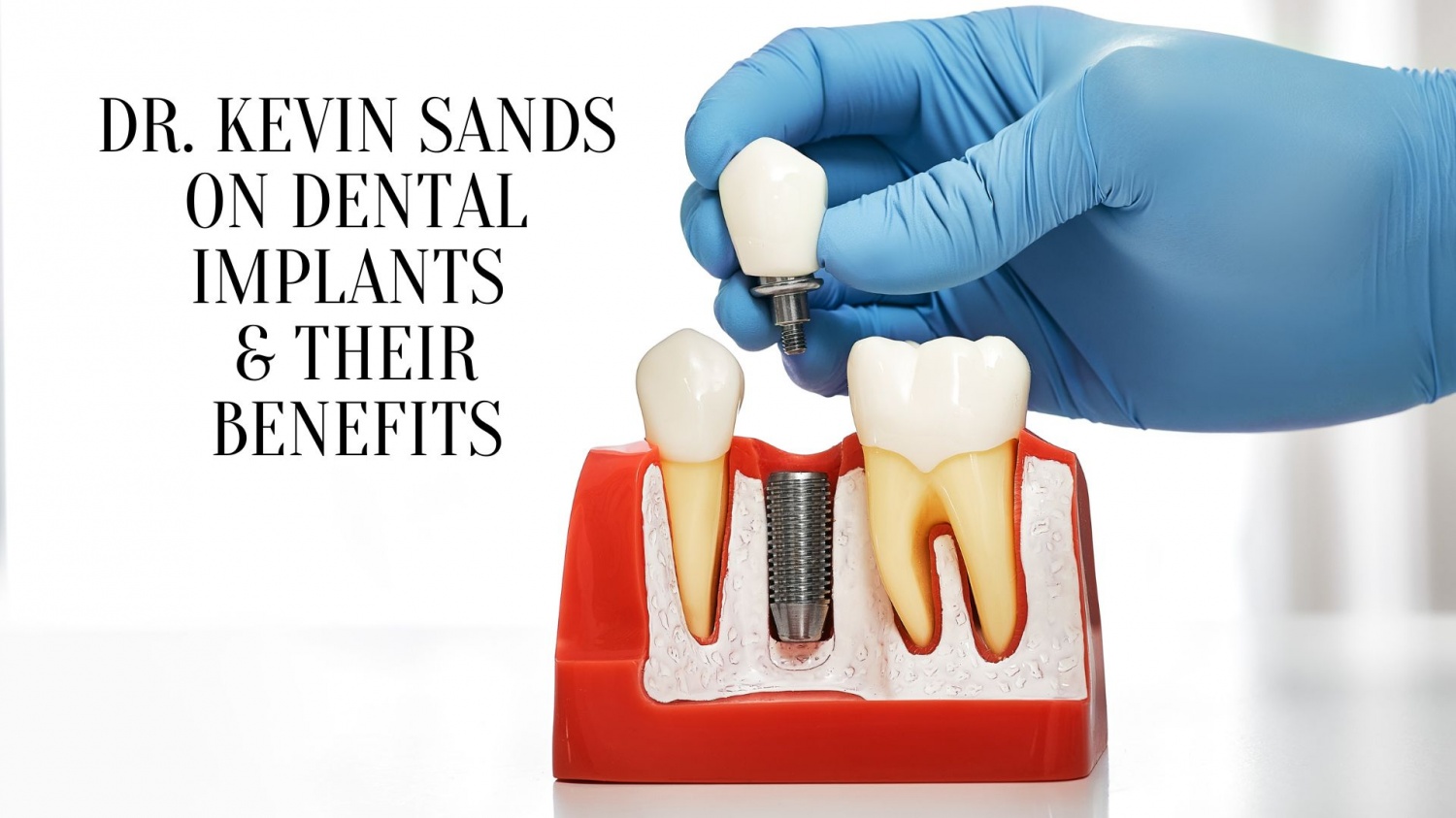 Dr. Kevin Sands on Dental Implants & Their Benefits